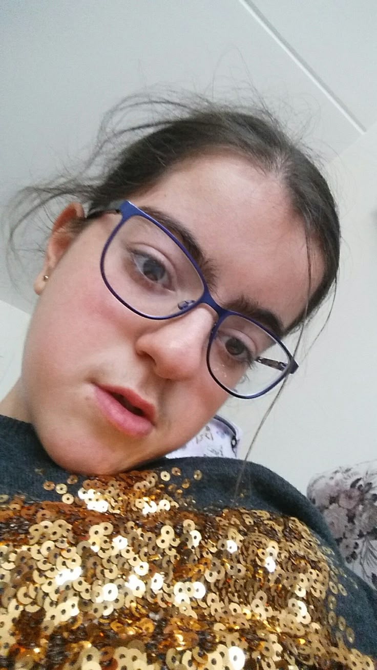 Прикрепление